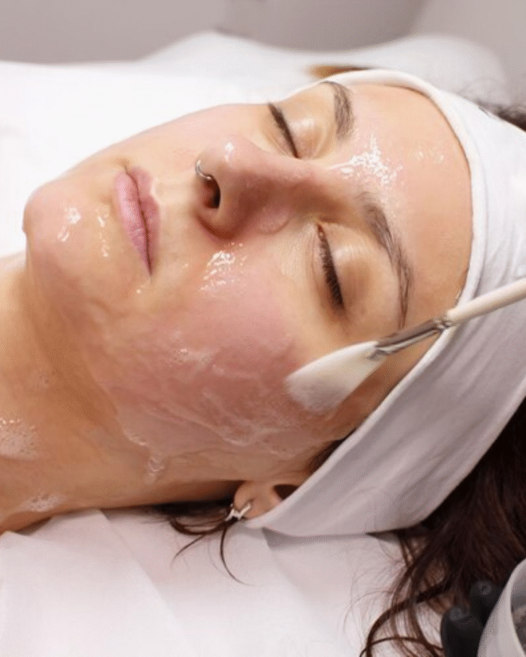 limpeza de pele + peeling Quimico superficial 1