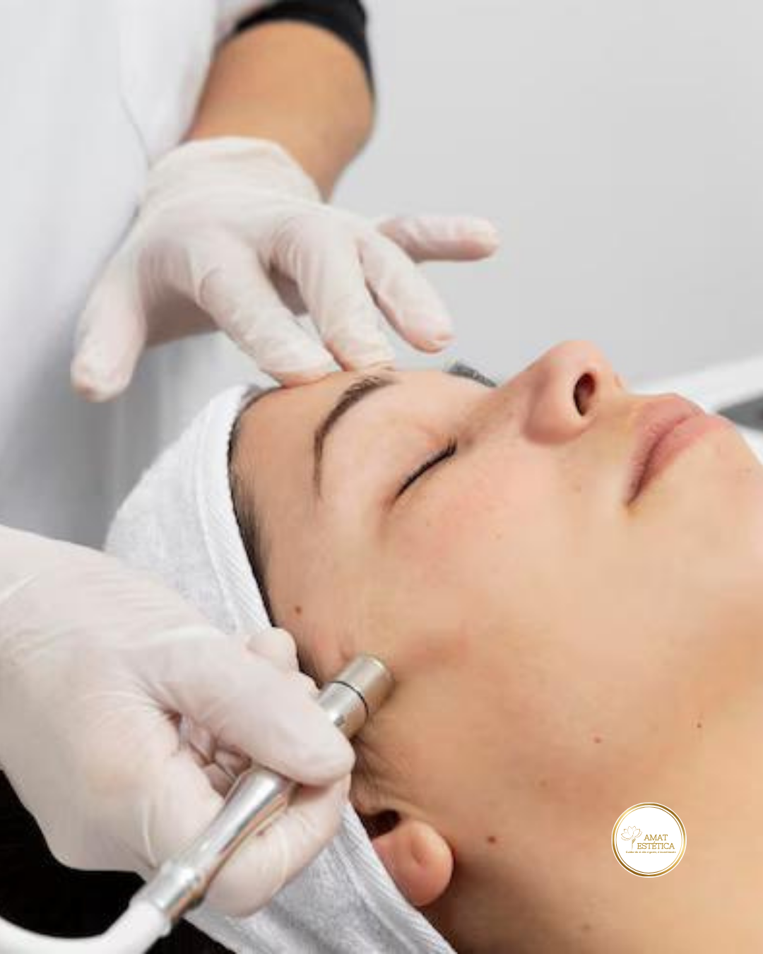 limpeza de pele + peeling dermoabrasão